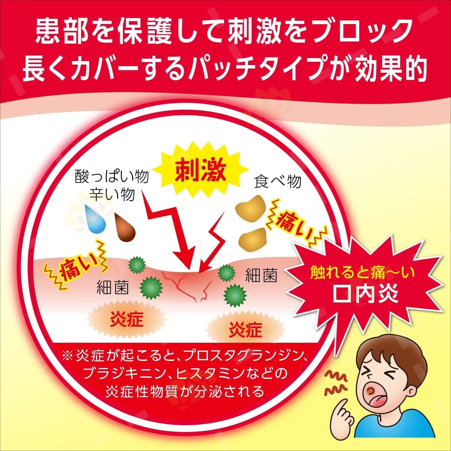 Taisho Stomatitis Inflammation & Sore Mouth Patch 10 pcs