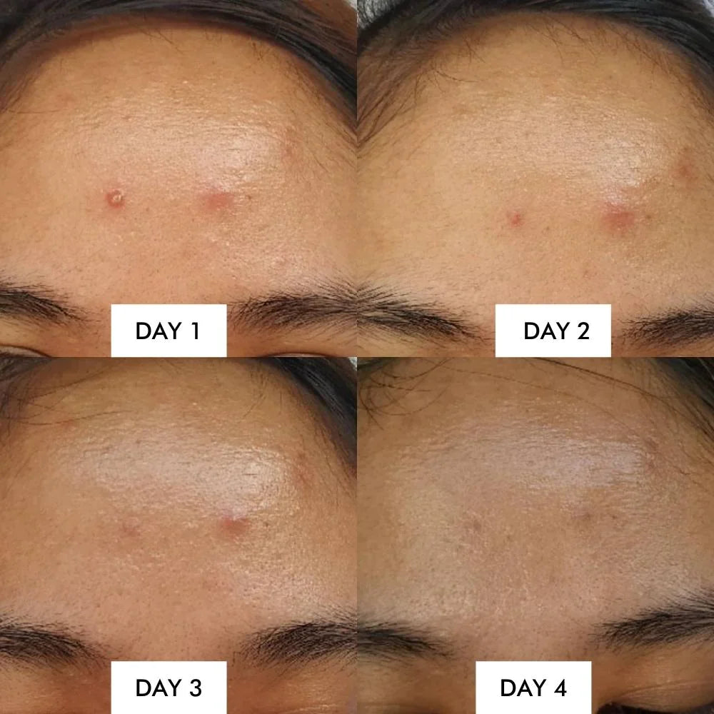 Some By Mi - AHA BHA PHA 14 Days Super Miracle Spot All Kill Cream 30ml