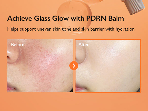 Genabelle PDRN Enriched Recovery Balm 50ml