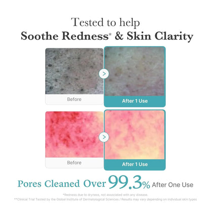 Medicube - Azelaic Acid Deep Clean Foam Cleanser 120ml