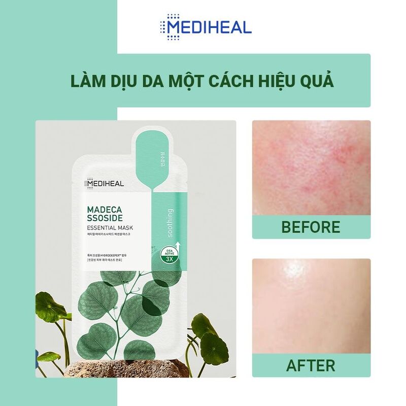 🎁 Mediheal Madecassoside Essential Mask 1pc (100% off)