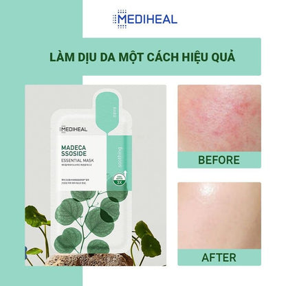 🎁 Mediheal Madecassoside Essential Mask 1pc (100% off)