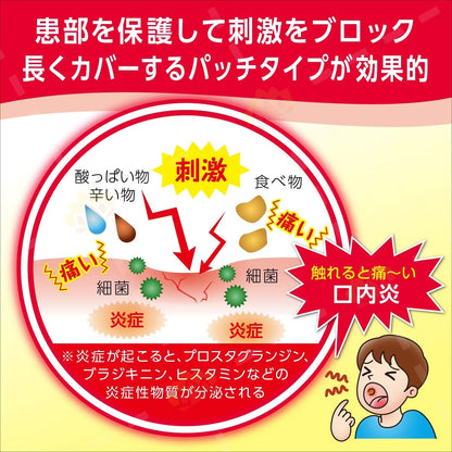 Taisho Stomatitis Inflammation & Sore Mouth Patch 10 pcs