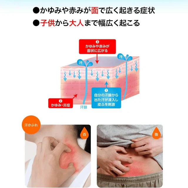 MUHI Ase Muhi EX Sweat Rash Cream 15g