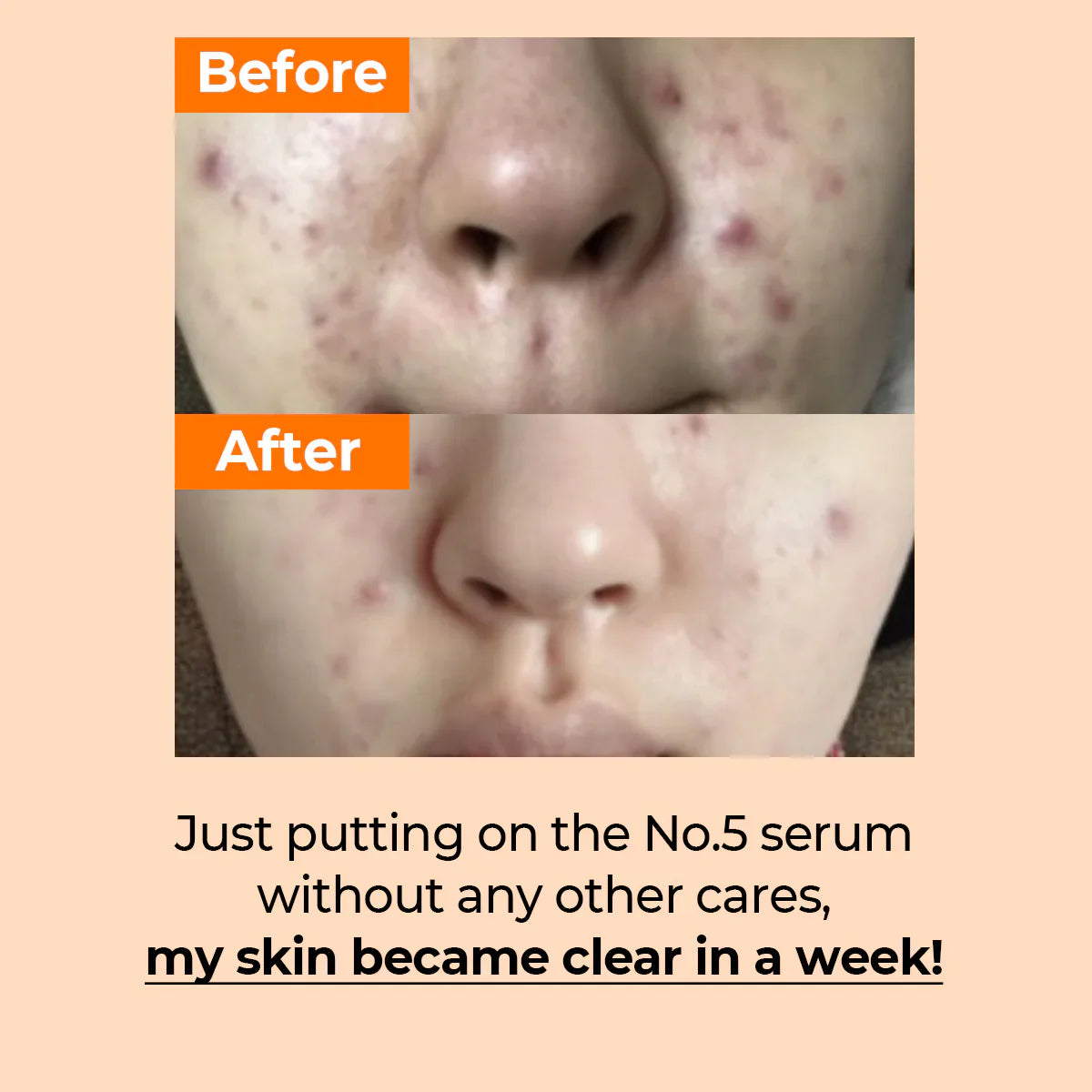 Numbuzin - No.5 Vitamin Concentrated Serum 30ml