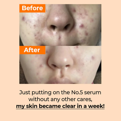Numbuzin - No.5 Vitamin Concentrated Serum 30ml