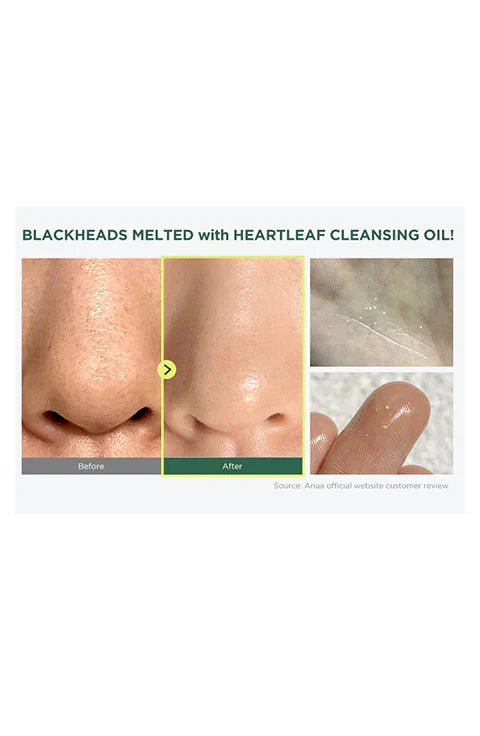 Anua - Heartleaf Pore Control Cleansing Oil
