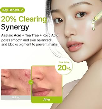 Purito SEOUL - Azelaic Acid 10 Kojic Tea Tree Serum 30ml