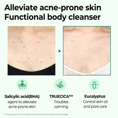 Some By Mi - AHA, BHA, PHA 30 Days Miracle Acne Clear Body Cleanser 400g