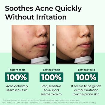 Some By Mi - AHA, BHA, PHA 30 Days Miracle Cream 60g