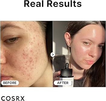 COSRX - The Niacinamide 15 Serum 20ml