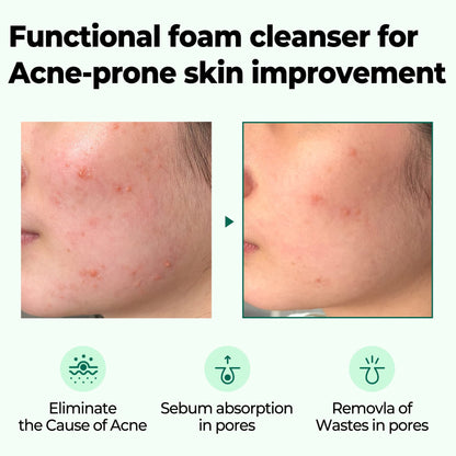 Some By Mi - AHA, BHA, PHA 30 Days Miracle Acne Clear Foam 100ml