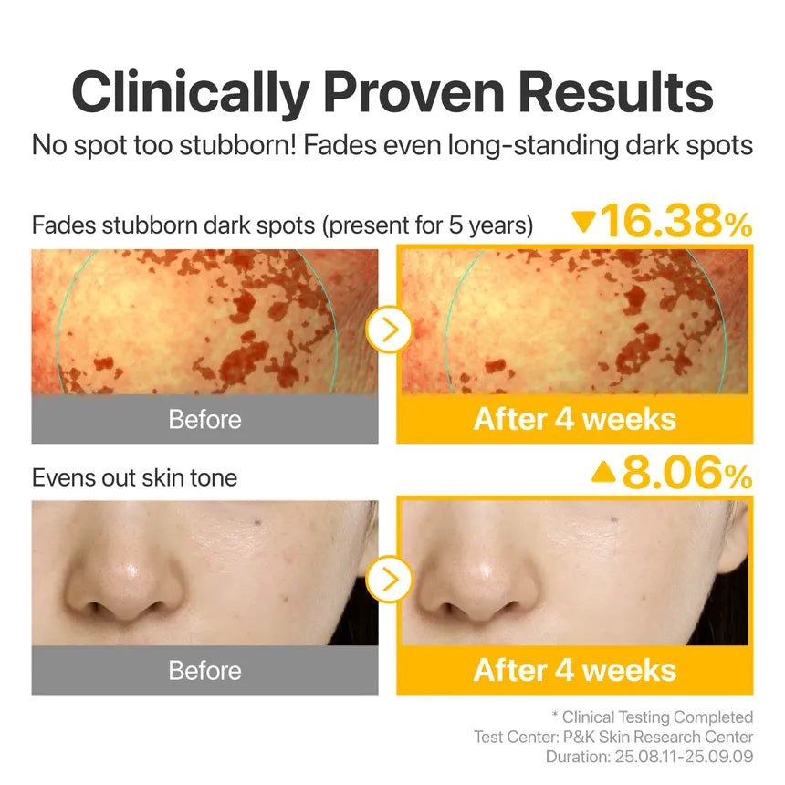 Numbuzin - No.5 Glutathione TXA Advanced Dark Spot Ampoule Concentrate 30ml