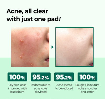 Some By Mi - AHA-BHA-PHA 30days Miracle Truecica Clear Pad - 70 pads