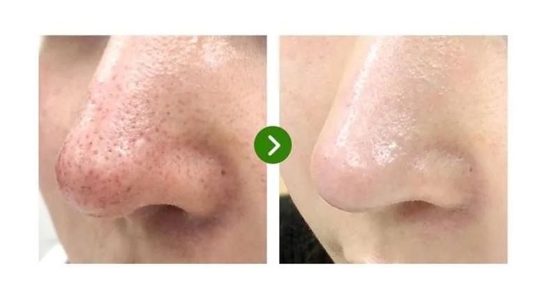 Some By Mi - Super Matcha Pore Tightening Serum 50ml