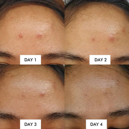 Some By Mi - AHA BHA PHA 14 Days Super Miracle Spot All Kill Cream 30ml